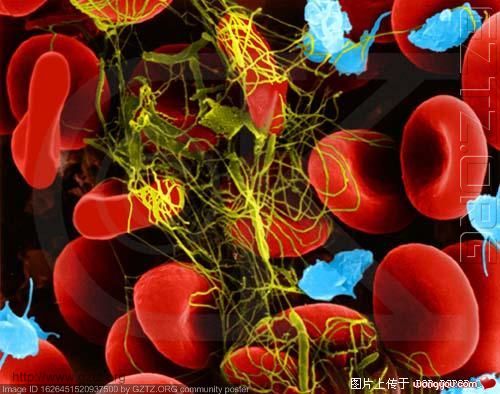 附件：血液凝块构造（红色为红血球，兰色为血小板，黄色为纤维蛋白）.jpg